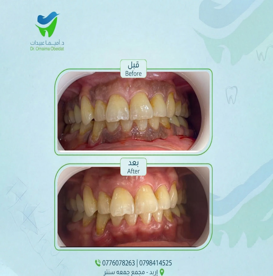 حالة عناية وتنظيف قبل وبعد